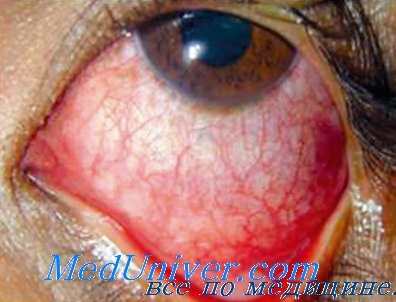 иммуномодуляторы при инфекции