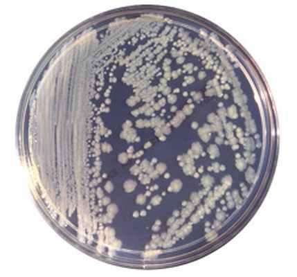 enterobacter cloacae