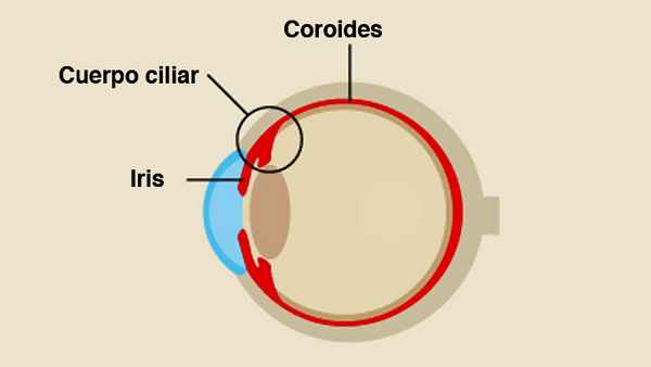 Diagram of the uveitis: iris, cuerpo ciliar, coroides
