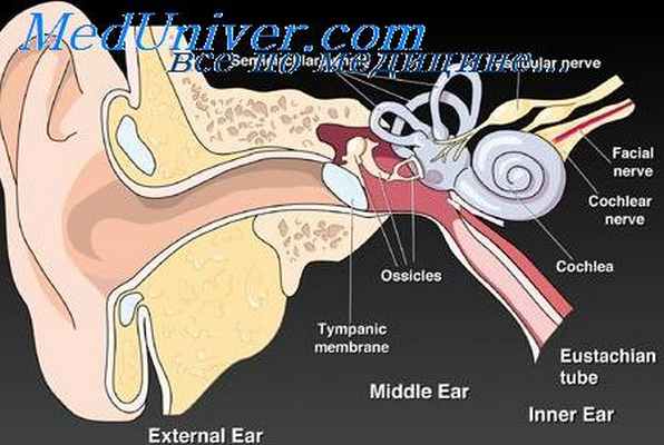 неврит слухового нерва