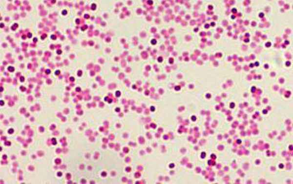 моракселла катаралис в носу