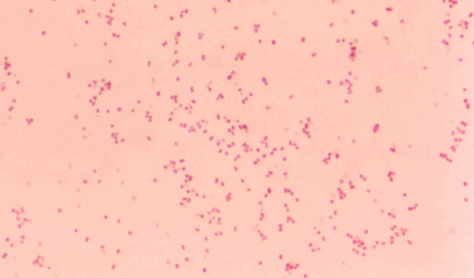 Moraxella Catarrhalis