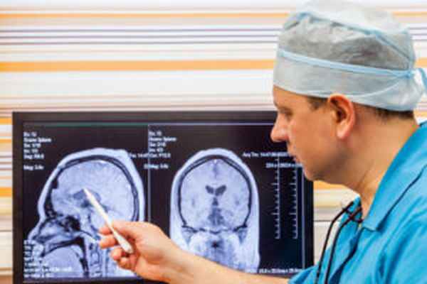 эпендимома