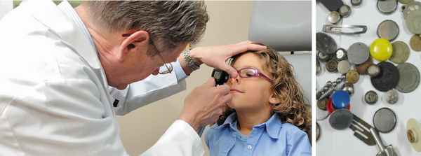 Извлечение инородных предметов из носа и пазух носа.jpg