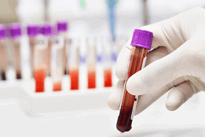 Диагностика инсулиномы