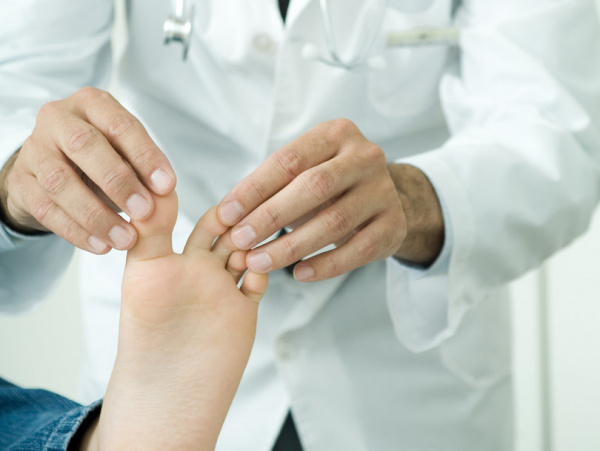 Интертриго