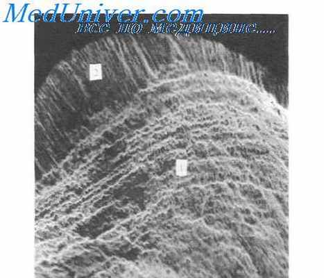 Эвагинация зуба