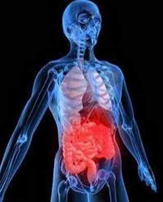 Ишемический колит. Клиника «МедЦентрСервис» – Киев, Печерск, Кловская. Фото.