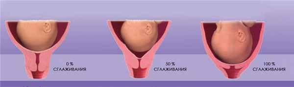 ИСТМИКО-Ц НЕДОСТАТОЧНОСТЬ.jpg