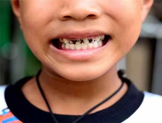 не лечить.jpg