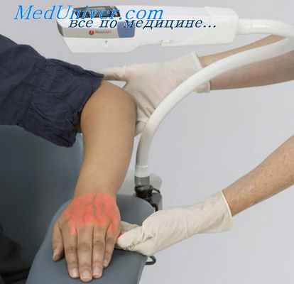 катетеризация артерий