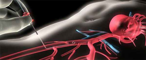 врачи-специалисты и медицинские центры в области Катетер для зондирования сердца