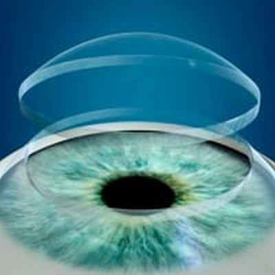 Лазерная кератопластика роговицы глаза - Центра глазной хирургии по лечению глаз, коррекции и восстановлению зрения при помощи лазера.