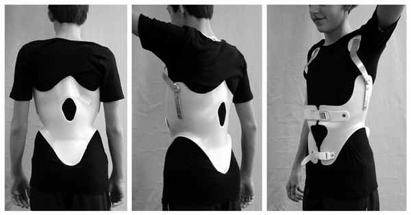 корсет для лечения кифоза