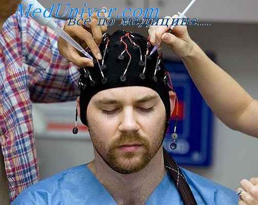 эпилептогенез