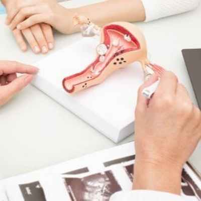 Киста бартолиновой железы