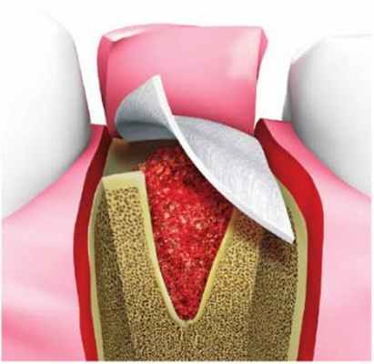 Барьерная мембрана 