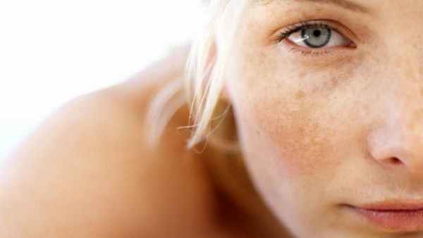 гиперпигментация кожи