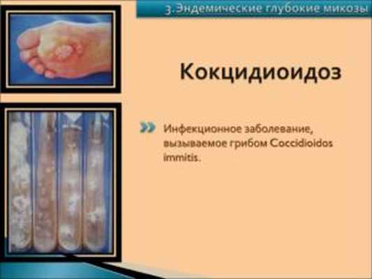 Кокцидиоидоз (coccidioidosis)