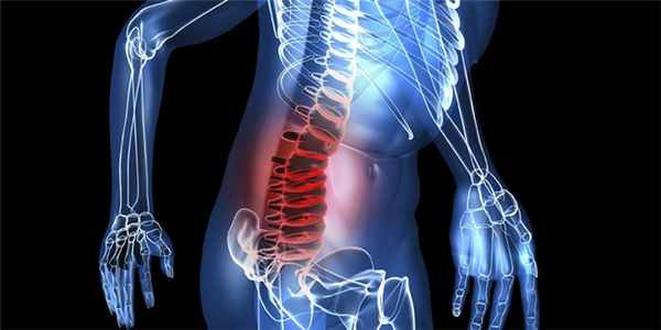 Компрессионный перелом - изображение 2