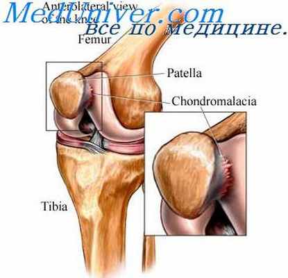 коленный сустав