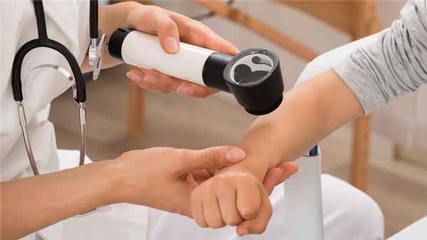 Контагиозный моллюск у детей