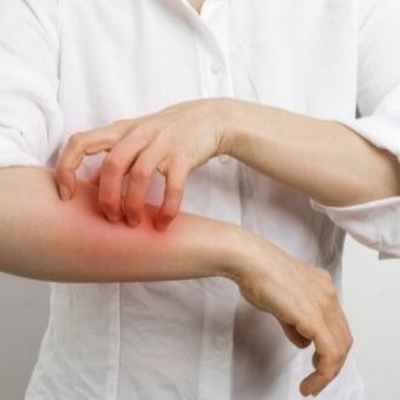 Контактный дерматит