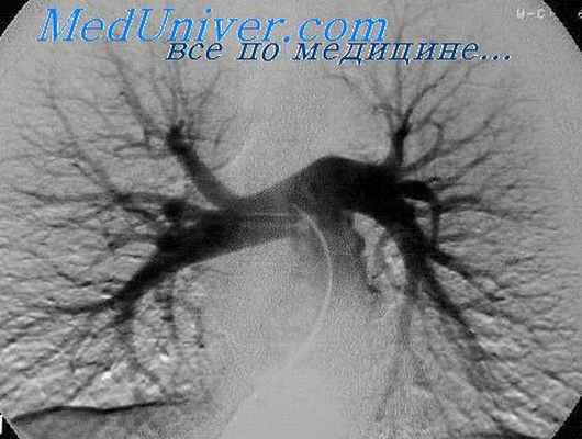 кардиотраст