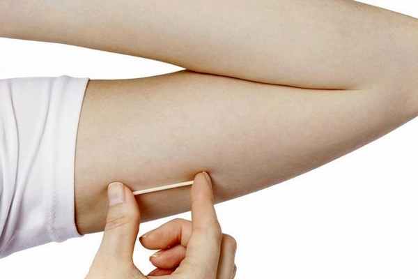 Установка и удаление Импланона