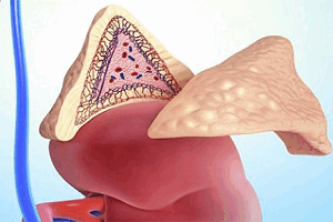 Опухоль надпочечника