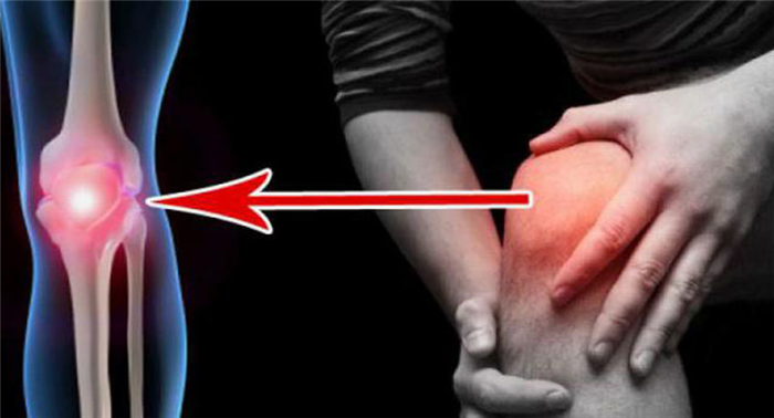 Саркома коленного сустава