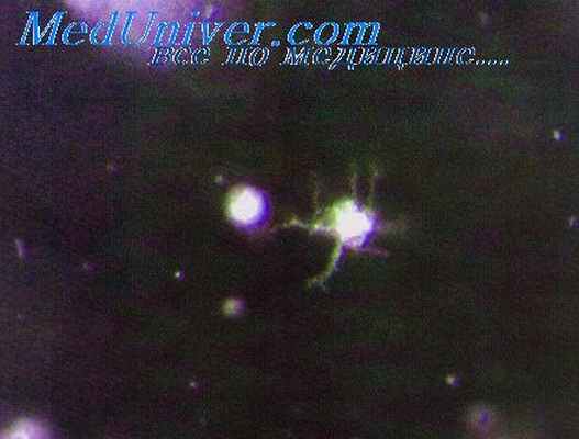 эндогенная астма