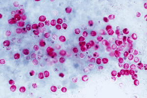 Криптоспоридиоз