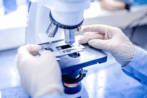 Анализ мазка