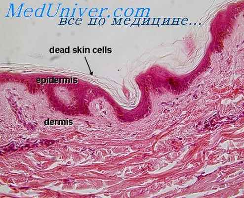 кровоизлияния