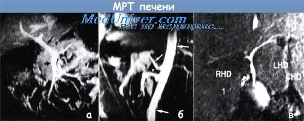 МРТ печени