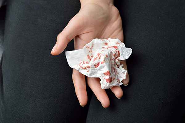 Кровохарканье 