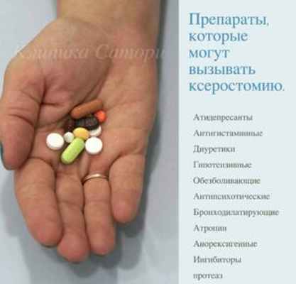 Ксеростомия, сухость во рту