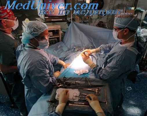 завершение лапароскопии