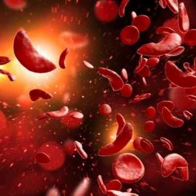 Анемия (малокровие)