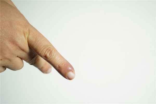 Инфекционное поражение.jpg