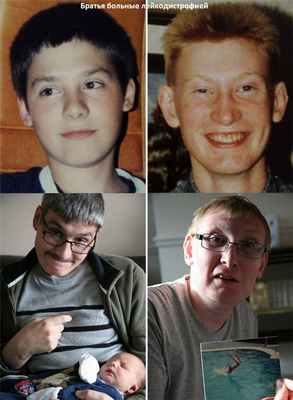 Лейкодистрофии