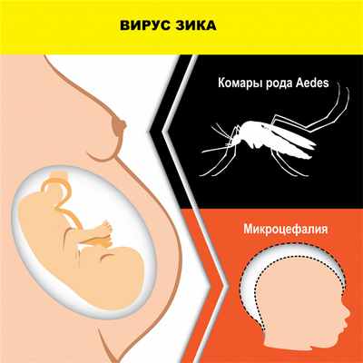 Вирус Зика.jpg
