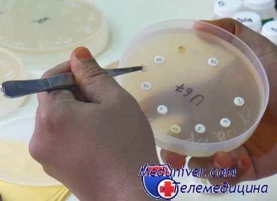 чумные бубоны