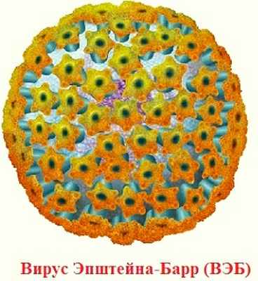 причины лимфомы Беркитта: вирус Эпштейна-Барр