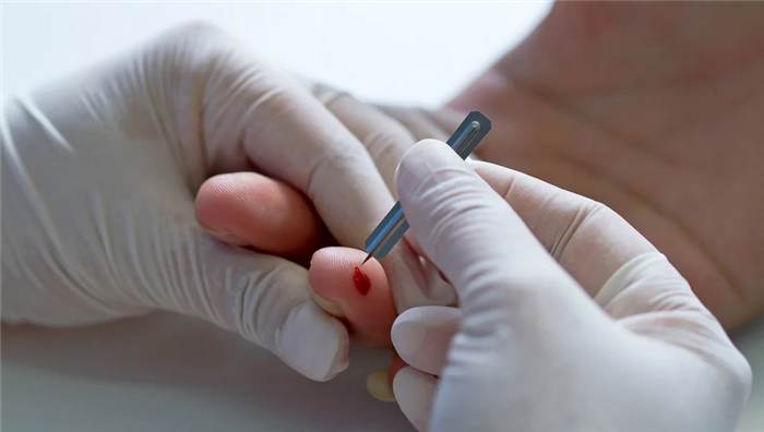 Общий анализ крови - метод выявления лимфопении