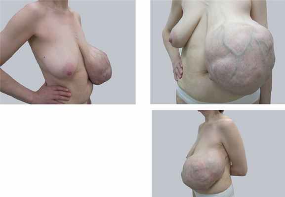 Больная В., 45 лет, внешний вид