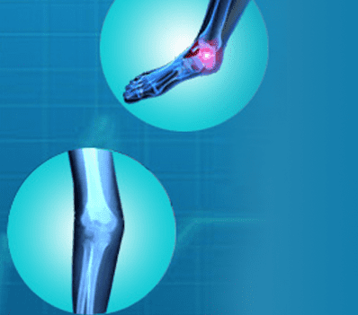 Что показывает МРТ голеностопного сустава