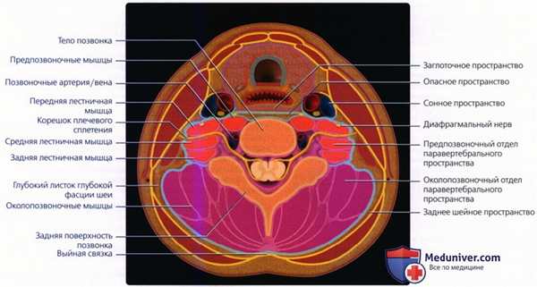 Введение в лучевую диагностику паравертебрального пространства: лучевая анатомия, методы исследования