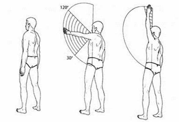 Болезненная дуга Доуборна